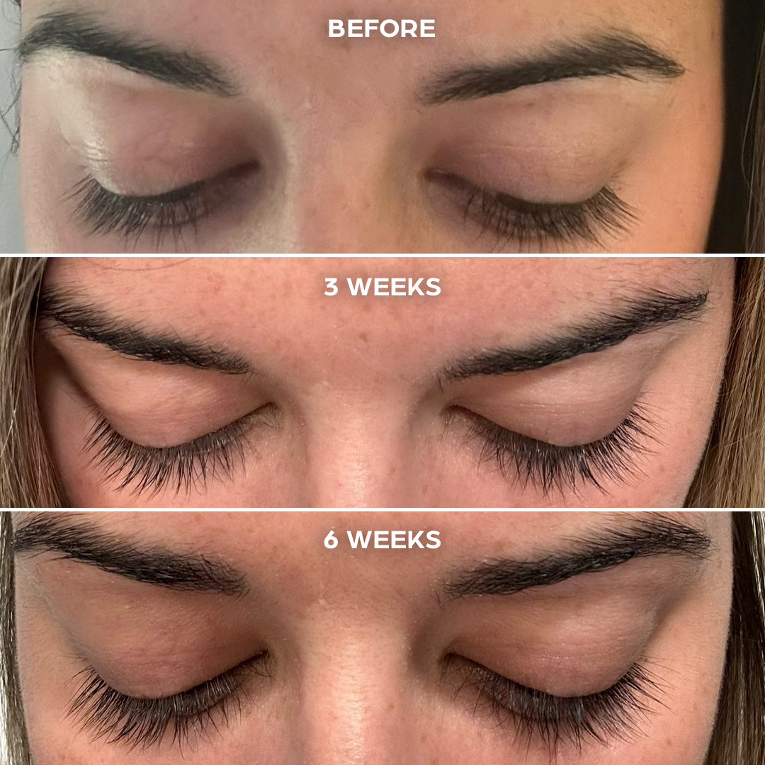 Lash + Brow Serum – Vellora