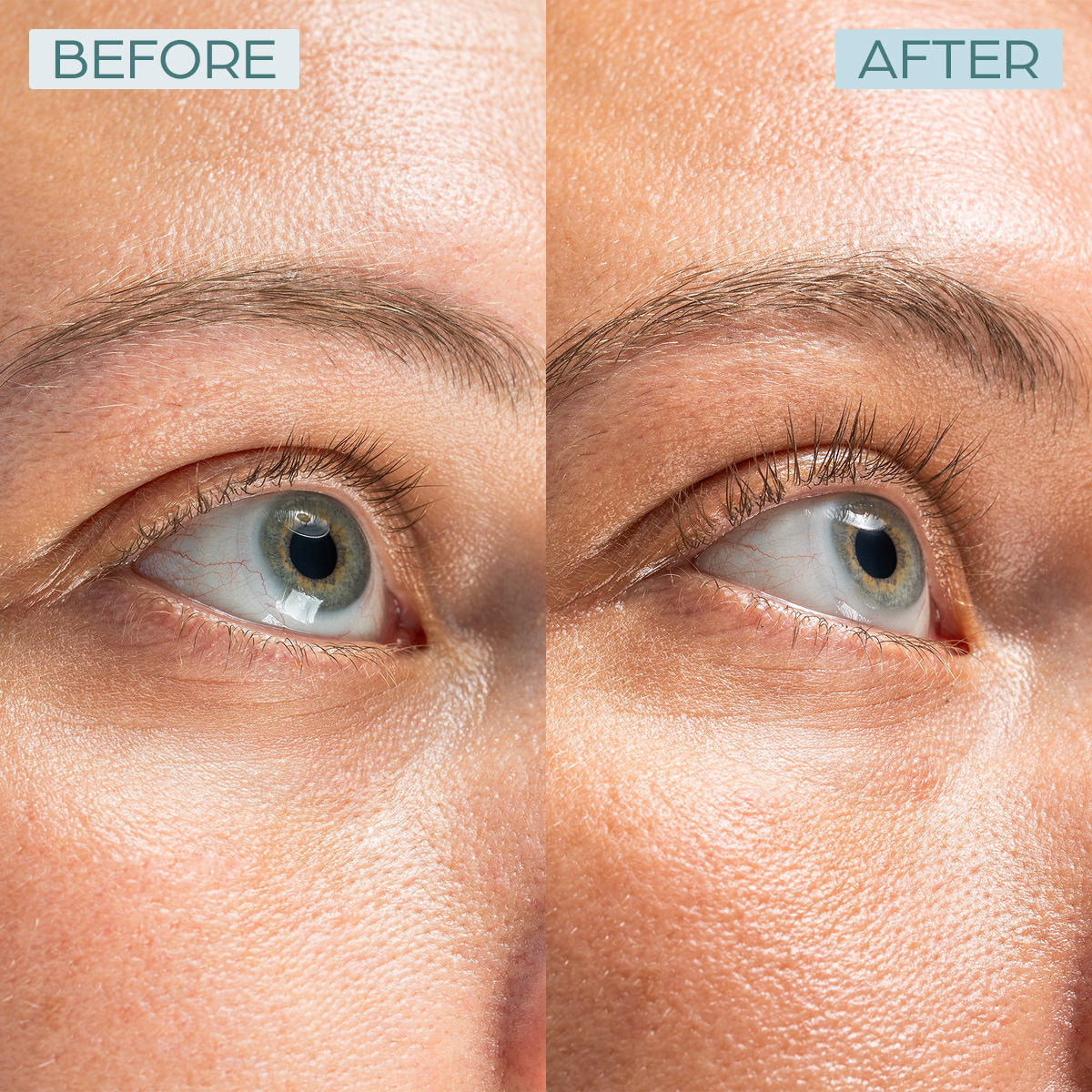 a comparison of a person's eyes