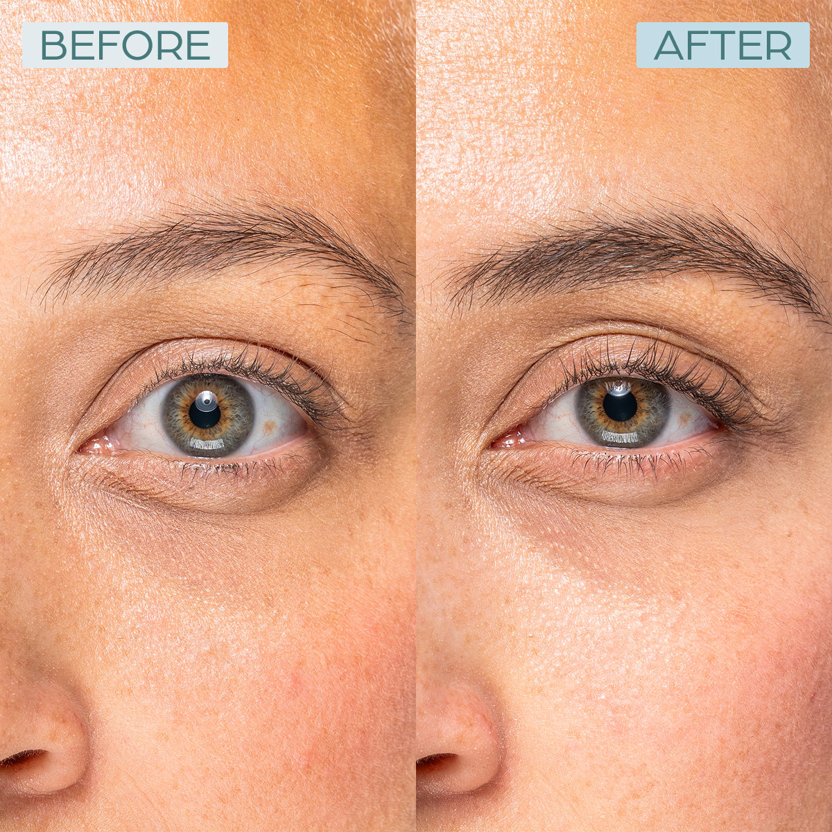 a comparison of a person's eyes